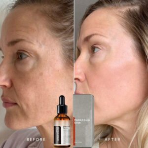 Vitamin C Spot-Removing Serum: Comprehensive Skin Improvement – Natural Anti-Aging Solution